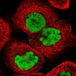 SCC112 Antibody, Novus Biologicals 0.1mL; Unlabeled:Antibodies, Polyclonal